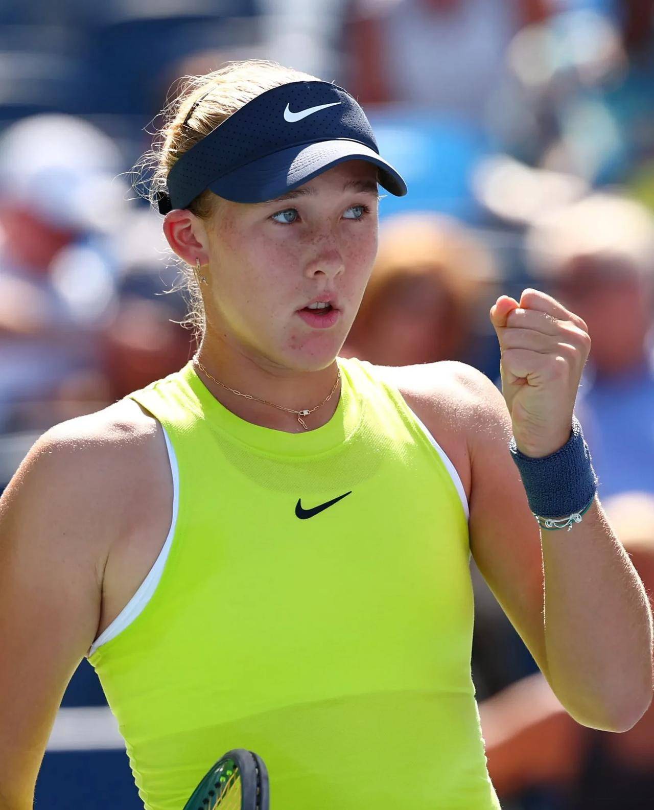 下的广泛区 下的广泛区